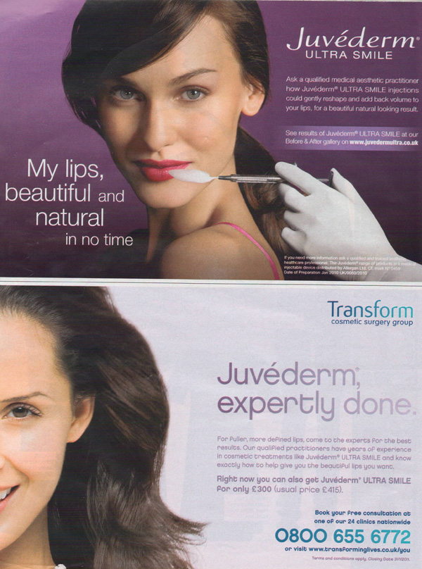 Allergan and Transform Medical advertising Juvederm Ultra